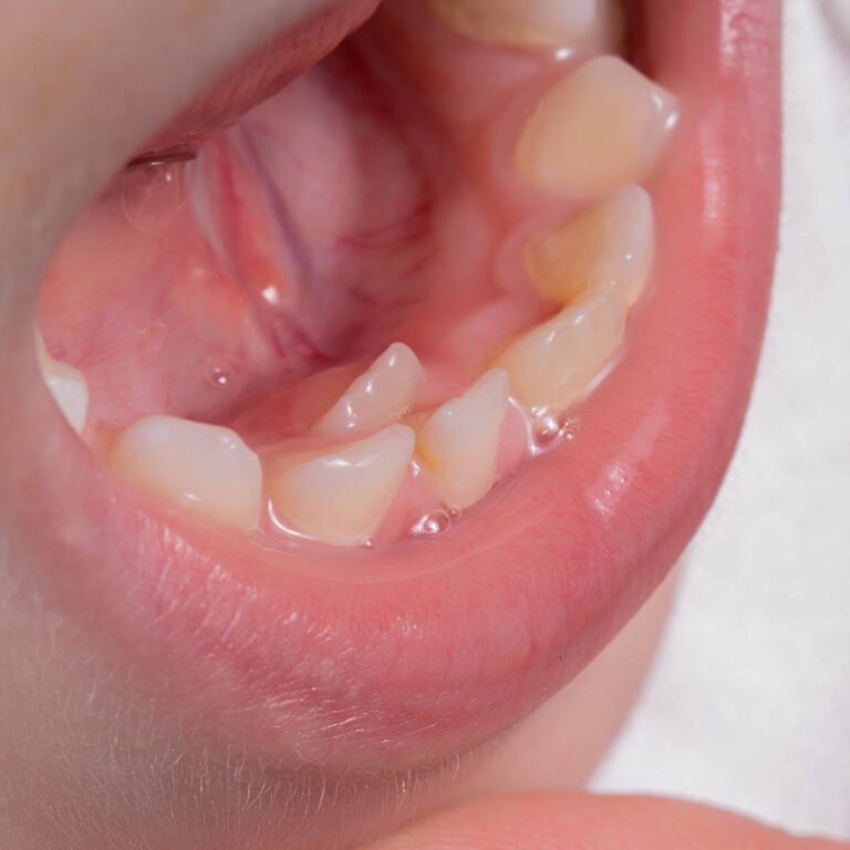 dental associated growth modifications
