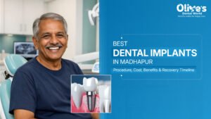 Best Dental Implants Treatment in Madhapur – Procedure, Cost, Benefits & Recovery Timeline
