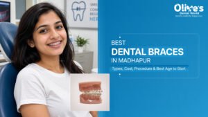 Best Dental Braces Treatment in Madhapur – Types, Cost, Procedure & Best Age to Start