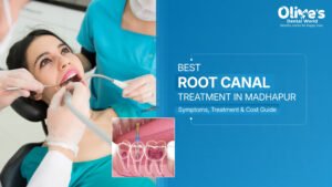 Best Root Canal in Madhapur – Symptoms, Treatment & Cost Guide