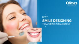 Best Smile Designing Treatment in Madhapur – Complete Smile Makeover Guide