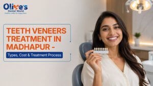 Teeth Veneers Treatment in Madhapur – Types, Cost & Treatment Process